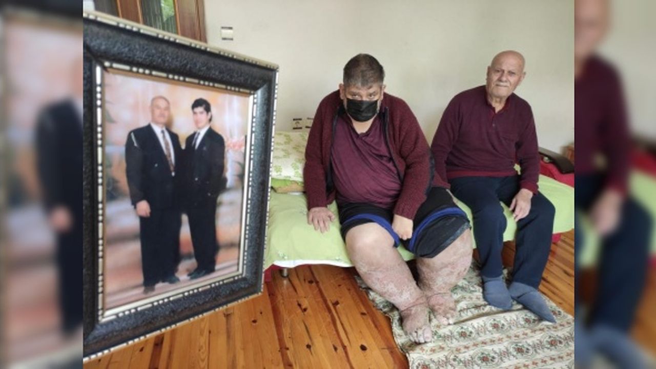 Sivrisinek, güvenlik görevlisinin hayatını kararttı