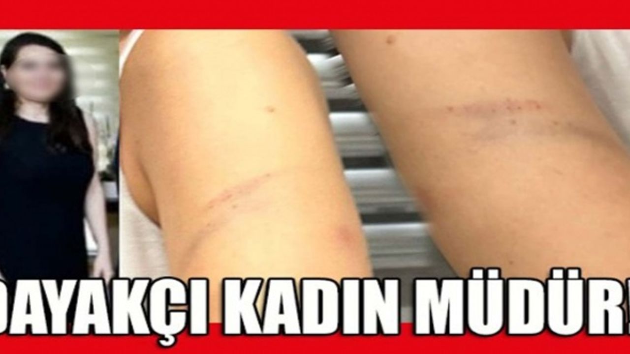 Kadın müdürden, kadın memura skandal dayak!